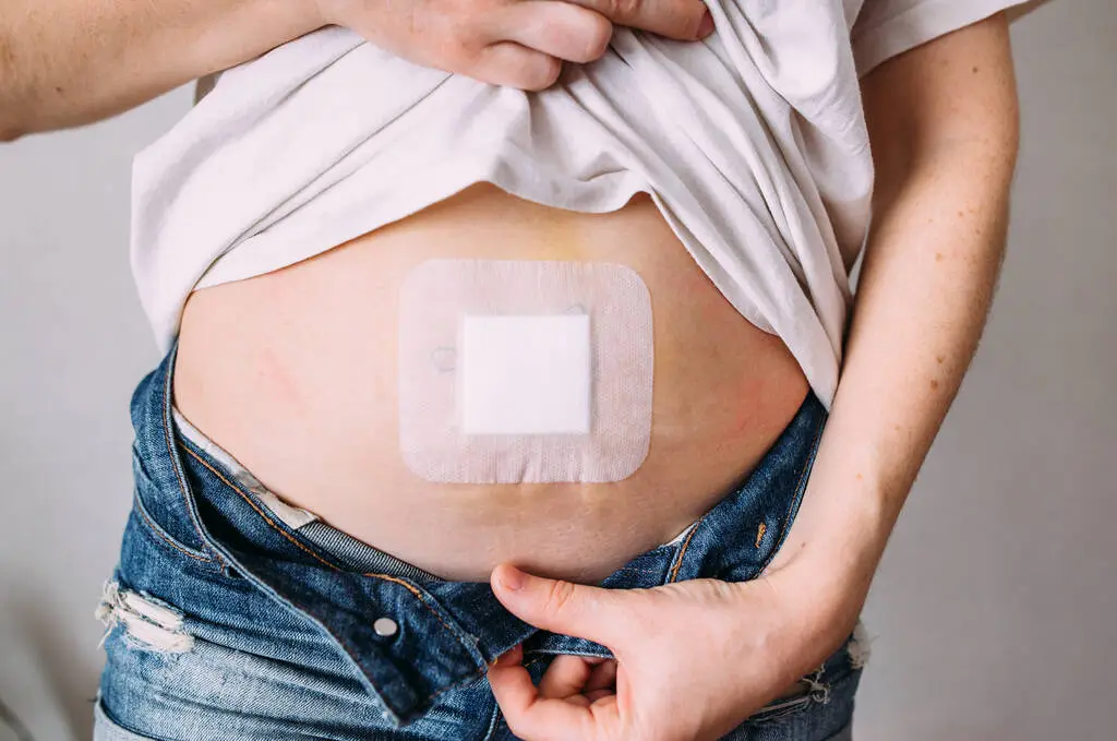 HRT Patch vs. Pill vs. Cream